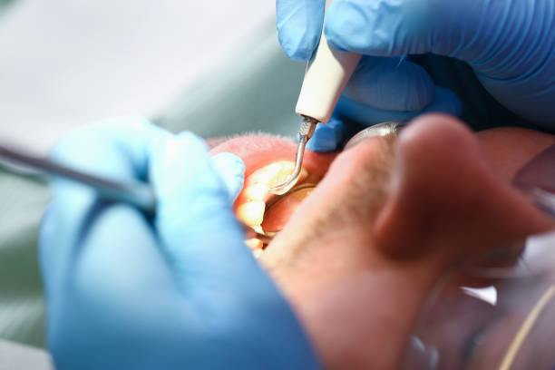 Best Emergency Denture Repair in Sumner, IL