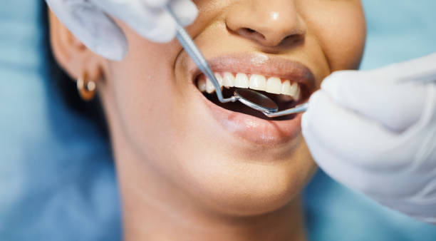 Professional Emergency Dental Service in IL